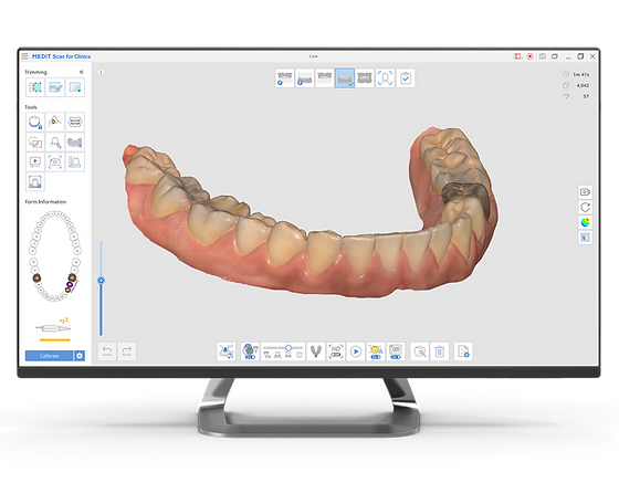 monitor image of dental scan of teeth with medit i600 digital scanner