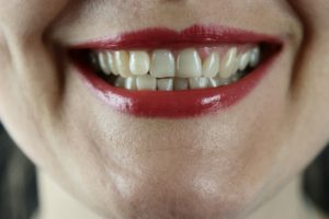 A woman with red lipstick is smiling showing her teeth.