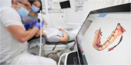 3D digital scanning